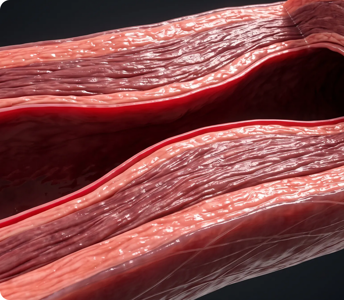 High Blood Pressure